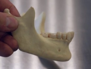 mandible picture