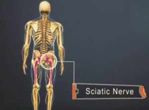 sciatic nerve picture location